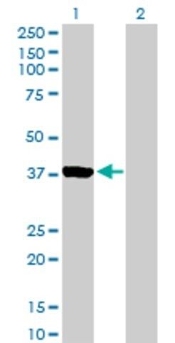 Anti-AURKC antibody produced in mouse