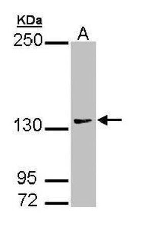 Anti-AUTS2 antibody produced in rabbit