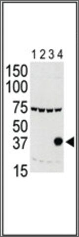Anti-Aurora-C (N-term M1) antibody produced in rabbit