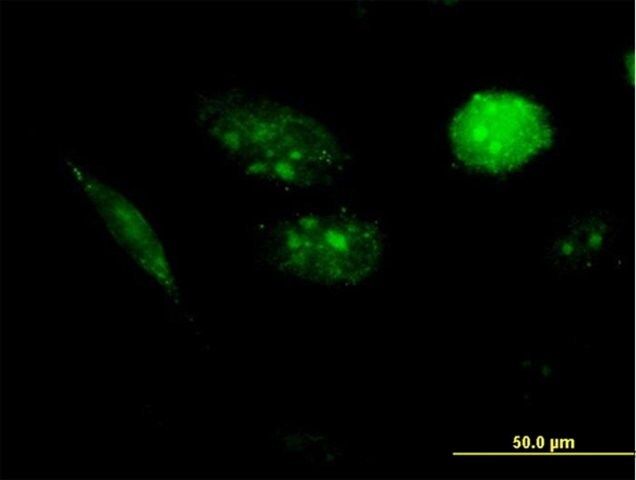 Anti-AURKAIP1 antibody produced in mouse