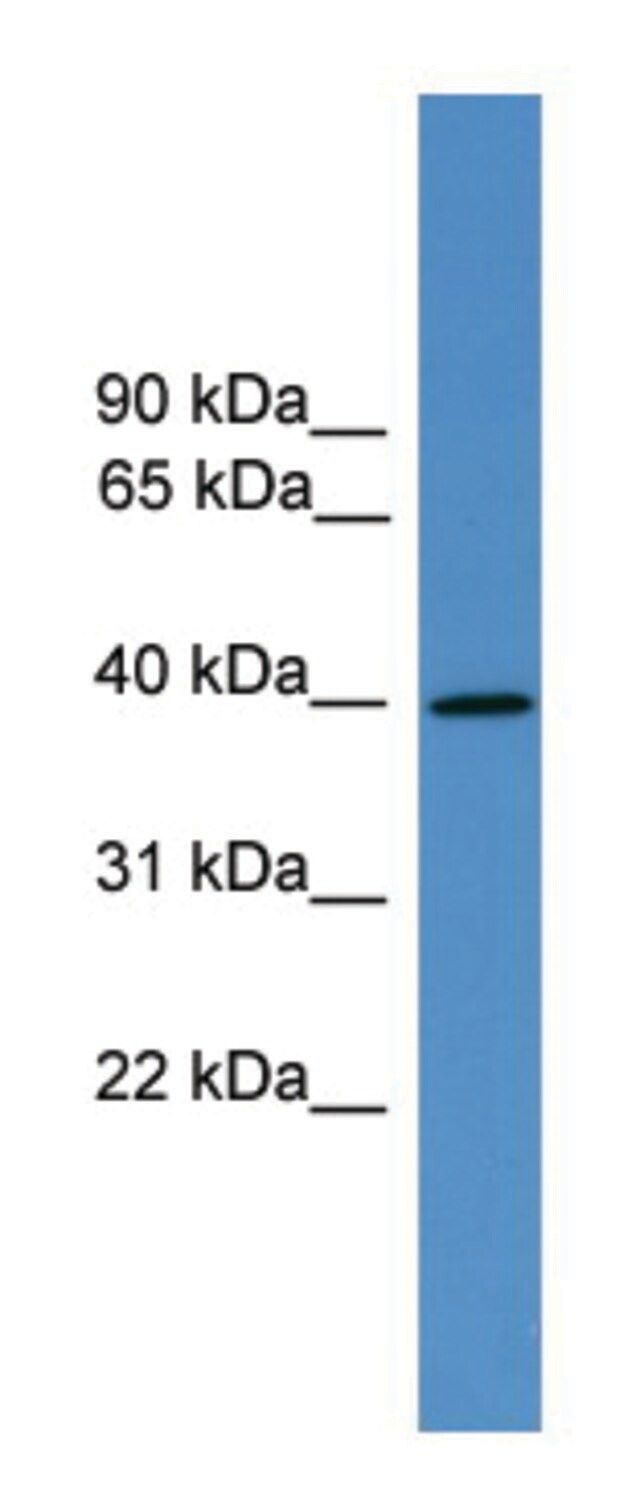 Anti-AVPR2 (C-terminal) antibody produced in rabbit