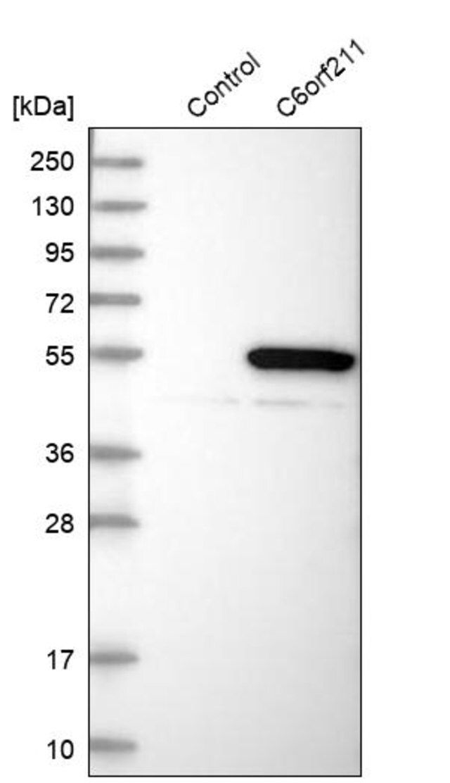 Anti-ARMT1 antibody produced in rabbit