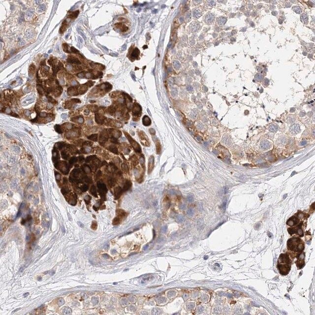 Anti-ARV1 antibody produced in rabbit
