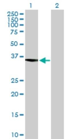 Anti-ASTE1, (N-terminal) antibody produced in mouse
