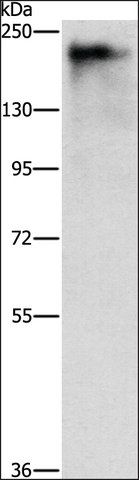 Anti-ATAD5 antibody produced in rabbit