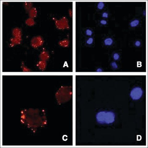 Anti-ASPORIN/ASPN antibody produced in goat