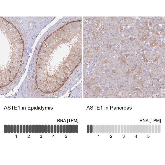 Anti-ASTE1 antibody produced in rabbit