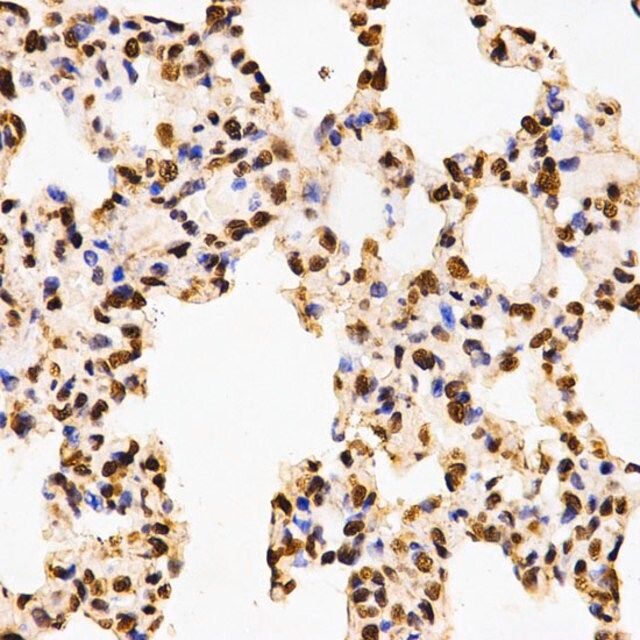 Anti-Asymmetric DiMethyl-Histone H3-R17 antibody produced in rabbit