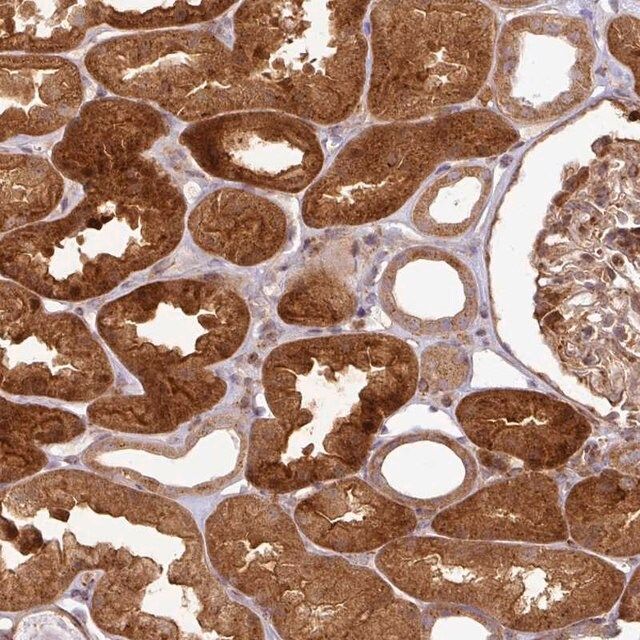 Anti-ATAT1 antibody produced in rabbit