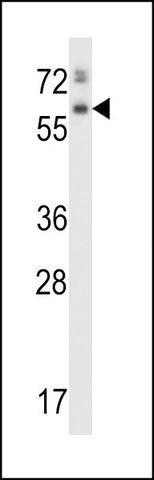ANTI-ASPG (CENTER) antibody produced in rabbit