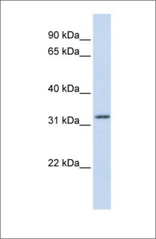 Anti-APTX antibody produced in rabbit