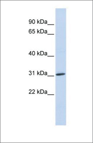 Anti-ARD1A antibody produced in rabbit