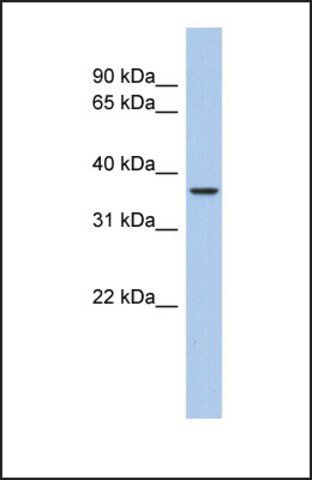 Anti-AQP10 antibody produced in rabbit