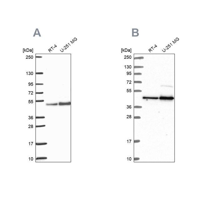 Anti-ARFGAP1 antibody produced in rabbit