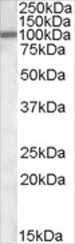 Anti-AREB6/ZEB1 antibody produced in goat