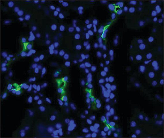 Anti-AQP2 antibody produced in rabbit