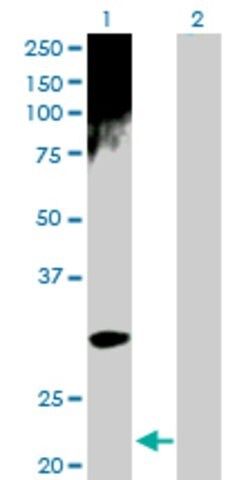Anti-ARD1A antibody produced in rabbit