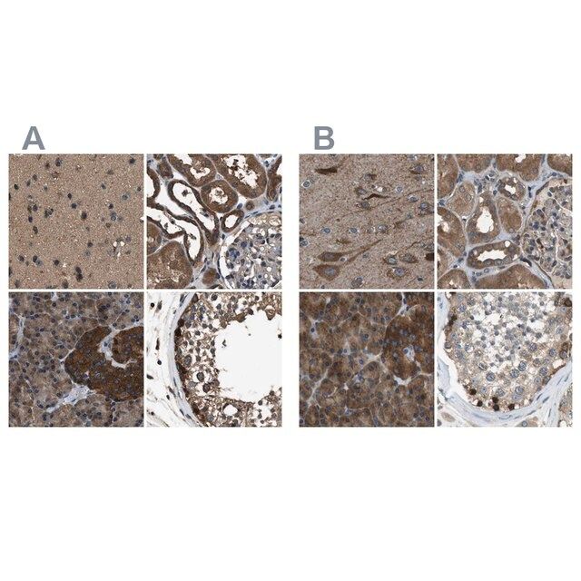Anti-ARFGAP2 antibody produced in rabbit