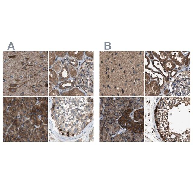 Anti-ARFGAP2 antibody produced in rabbit