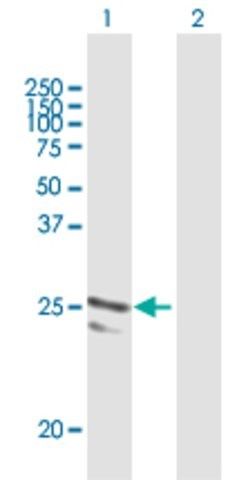 Anti-ARFRP1 antibody produced in mouse