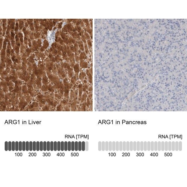 Anti-ARG1 antibody produced in rabbit
