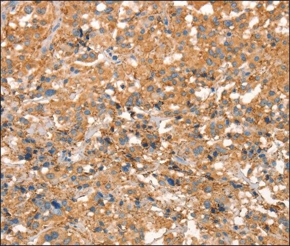 Anti-ARFGEF2 antibody produced in rabbit