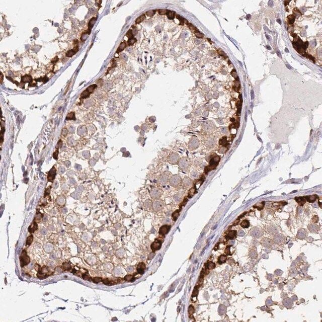 Anti-ARHGAP35 antibody produced in rabbit