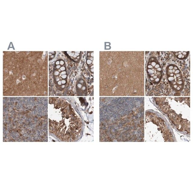 Anti-ARHGEF11 antibody produced in rabbit
