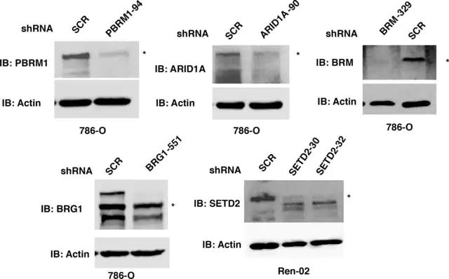 Anti-ARID1A antibody produced in rabbit