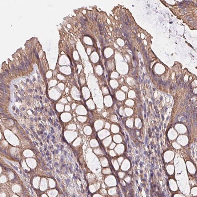 Anti-ARHGEF39 antibody produced in rabbit