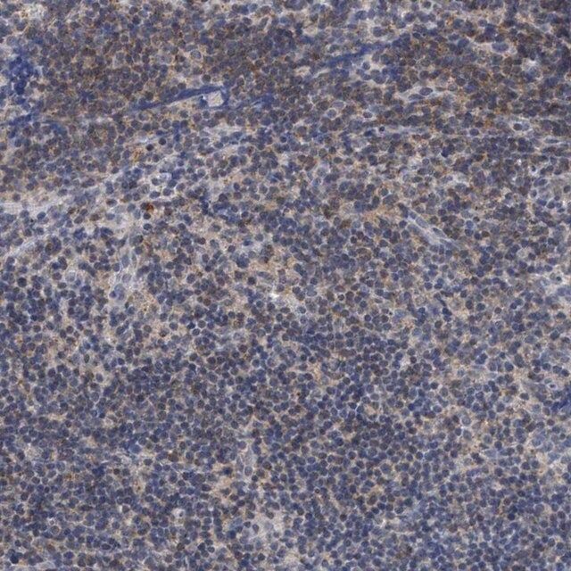 Anti-ANKRD55 antibody produced in rabbit