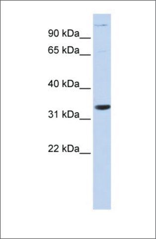 Anti-ANP32B antibody produced in rabbit