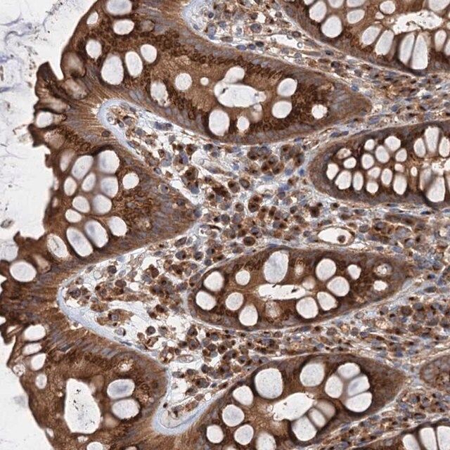 Anti-ANKRD26 antibody produced in rabbit