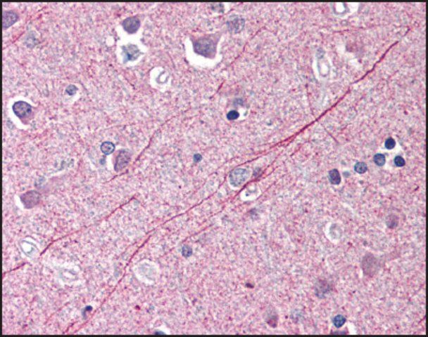 Anti-ANP32E antibody produced in rabbit