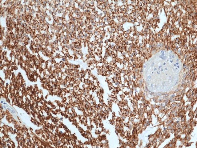 Anti-ANO1 / DOG1 / TMEM16A Rabbit Monoclonal Antibody