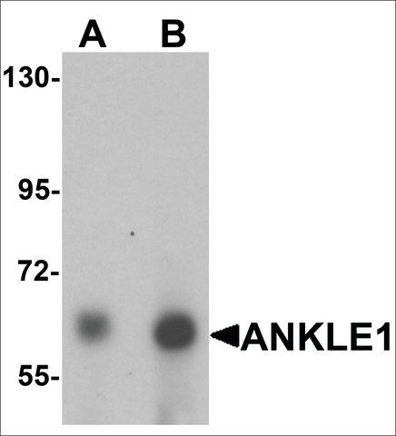 Anti-ANKLE1 antibody produced in chicken