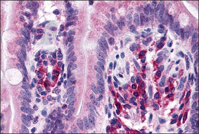 Anti-ANKRD27 antibody produced in rabbit