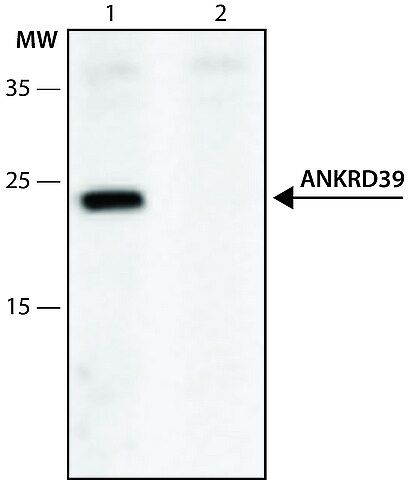 Anti-ANKRD39 (28-38) antibody produced in rabbit