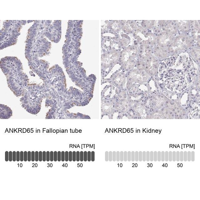 Anti-ANKRD65 antibody produced in rabbit