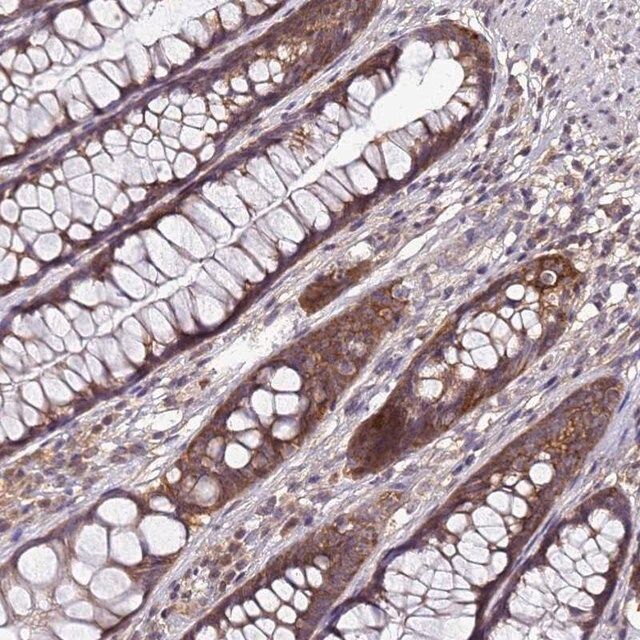 Anti-ANKRD17 antibody produced in rabbit