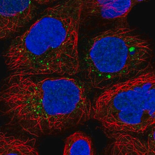 Anti-ANKRD6 antibody produced in rabbit