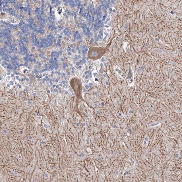 Anti-ANKRD16 antibody produced in rabbit