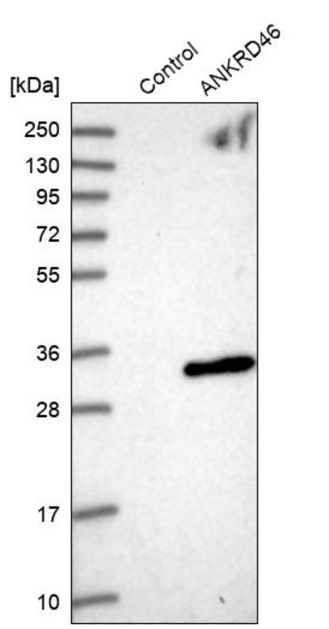 Anti-ANKRD46 antibody produced in rabbit