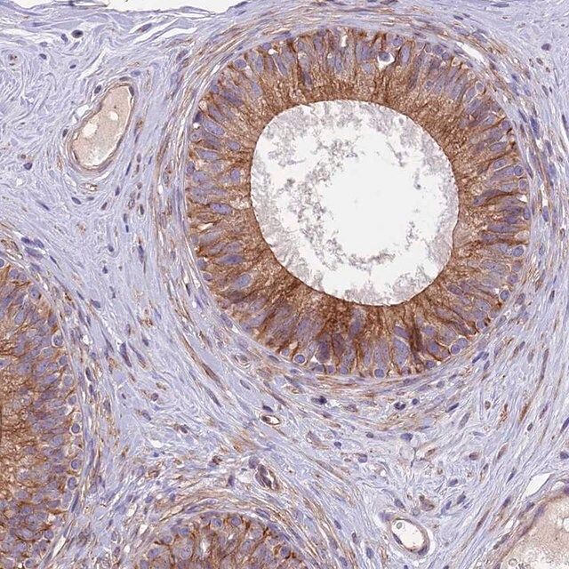 Anti-ANO3 antibody produced in rabbit