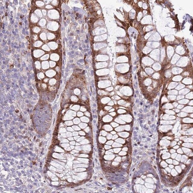 Anti-ANO8 antibody produced in rabbit