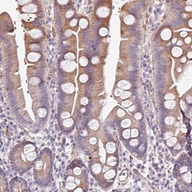 Anti-ANO9 antibody produced in rabbit