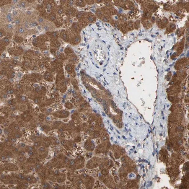 Anti-ALDH9A1 antibody produced in rabbit