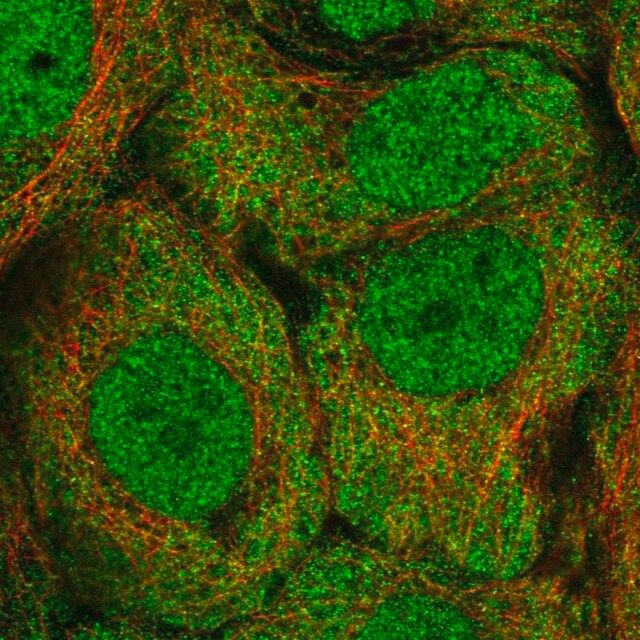 Anti-ALDH1A3 antibody produced in rabbit