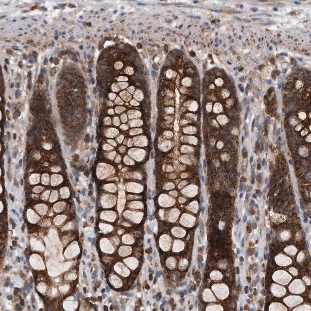 Anti-ALPK2 antibody produced in rabbit