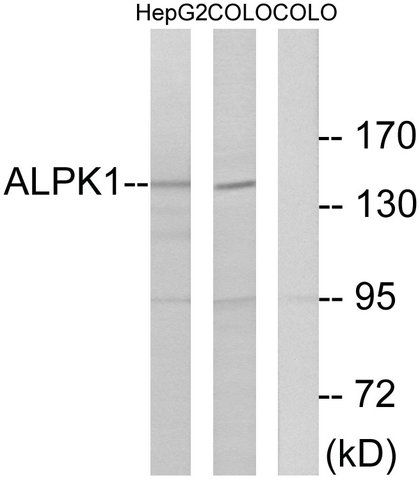 Anti-ALPK1, N-Terminal antibody produced in rabbit